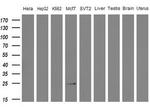 WIBG Antibody in Western Blot (WB)