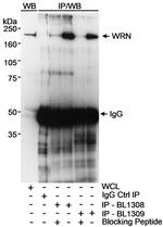 WRN Antibody in Western Blot (WB)