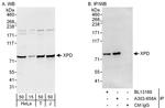 XPD Antibody in Western Blot (WB)