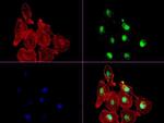 XRCC1 Antibody in Immunocytochemistry (ICC/IF)