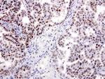 XRCC1 Antibody in Immunohistochemistry (Paraffin) (IHC (P))