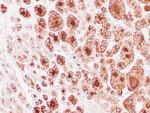 Thyroglobulin Antibody in Immunohistochemistry (Paraffin) (IHC (P))