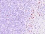 Thymidylate Synthase Antibody in Immunohistochemistry (Paraffin) (IHC (P))