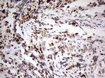 ZEB1 Antibody in Immunohistochemistry (Paraffin) (IHC (P))