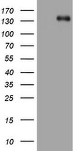 ZEB1 Antibody in Western Blot (WB)