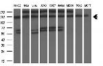 ZEB1 Antibody in Western Blot (WB)