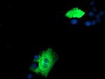 ZFP36 Antibody in Immunocytochemistry (ICC/IF)