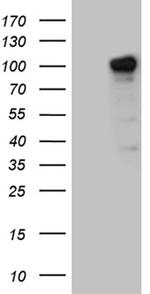 ZHX2 Antibody in Western Blot (WB)