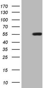 ZIC3 Antibody in Western Blot (WB)