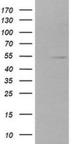 ZSCAN21 Antibody in Western Blot (WB)