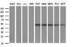 ZSCAN21 Antibody in Western Blot (WB)