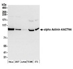 alpha Actinin 4/ACTN4 Antibody in Western Blot (WB)