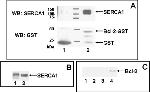 SERCA1 ATPase Antibody in Western Blot, Immunoprecipitation (WB, IP)