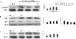 CDK4 Antibody in Western Blot (WB)