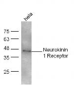 Neurokinin 1 Receptor Antibody in Western Blot (WB)