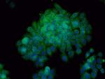 Bax Antibody in Immunocytochemistry (ICC/IF)