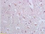 Bax Antibody in Immunohistochemistry (Paraffin) (IHC (P))