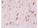 Bax Antibody in Immunohistochemistry (Paraffin) (IHC (P))