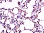 Bax Antibody in Immunohistochemistry (Paraffin) (IHC (P))