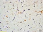 IRS-2 Antibody in Immunohistochemistry (Paraffin) (IHC (P))