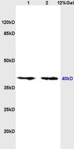 Nociceptin receptor Antibody in Western Blot (WB)