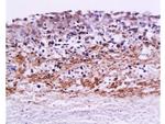 MMP9 Antibody in Immunohistochemistry (Paraffin) (IHC (P))