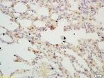 TIGAR Antibody in Immunohistochemistry (Paraffin) (IHC (P))