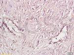 FGFR4/CD334 Antibody in Immunohistochemistry (Paraffin) (IHC (P))