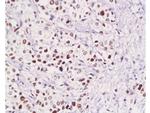 Pokemon Antibody in Immunohistochemistry (Paraffin) (IHC (P))