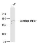 Leptin receptor Antibody in Western Blot (WB)