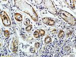 CD38 Antibody in Immunohistochemistry (Paraffin) (IHC (P))