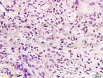 Integrin beta 7 Antibody in Immunohistochemistry (Paraffin) (IHC (P))