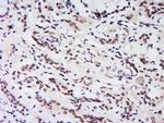 HS1BP3 Antibody in Immunohistochemistry (Paraffin) (IHC (P))