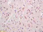 Huntingtin Antibody in Immunohistochemistry (Paraffin) (IHC (P))