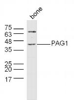 PAG1 Antibody in Western Blot (WB)