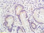 SLUG Antibody in Immunohistochemistry (Paraffin) (IHC (P))