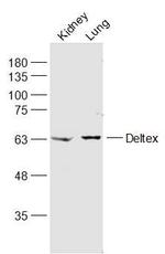 Deltex Antibody in Western Blot (WB)