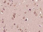 DHI1L Antibody in Immunohistochemistry (Paraffin) (IHC (P))