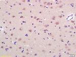 GRP75 Antibody in Immunohistochemistry (Paraffin) (IHC (P))