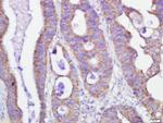 GRP75 Antibody in Immunohistochemistry (Paraffin) (IHC (P))