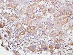 GRP75 Antibody in Immunohistochemistry (Paraffin) (IHC (P))