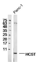 HCST Antibody in Western Blot (WB)