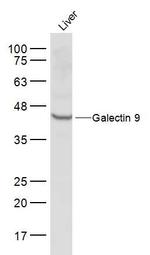 Galectin 9 Antibody in Western Blot (WB)