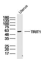 TRIT1 Antibody in Western Blot (WB)