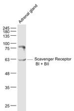 Scavenger Receptor BI/BII Antibody in Western Blot (WB)