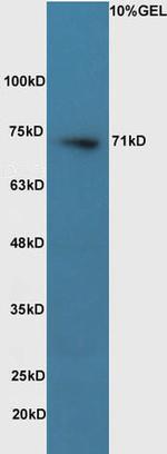 Pro-NRG1 Antibody in Western Blot (WB)