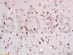 PEG3 Antibody in Immunohistochemistry (Paraffin) (IHC (P))