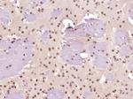 Neurogenic locus notch homolog protein 1 Antibody in Immunohistochemistry (Paraffin) (IHC (P))