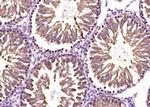 Rad51 Antibody in Immunohistochemistry (Paraffin) (IHC (P))