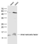 ANP Antibody in Western Blot (WB)